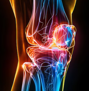 고관절 통증 증상 16