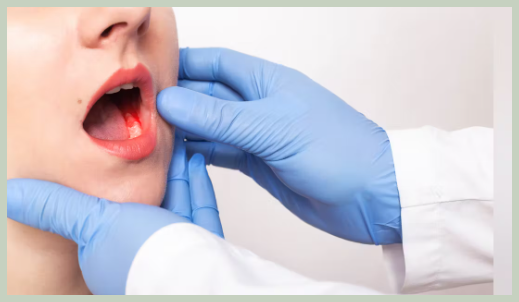 입안 염증 예방