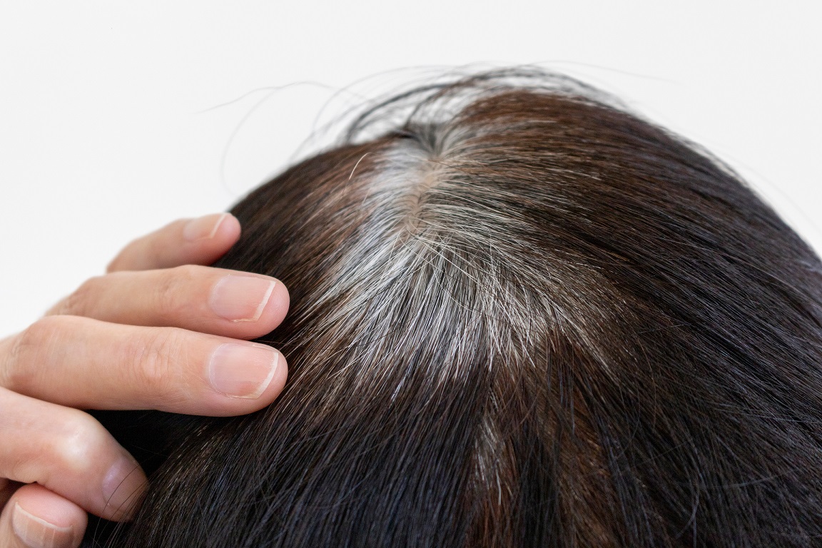 흰머리의 원인과 이유부터 흰머리에 좋은 5가지 음식 - 흰머리 관리의 모든 것