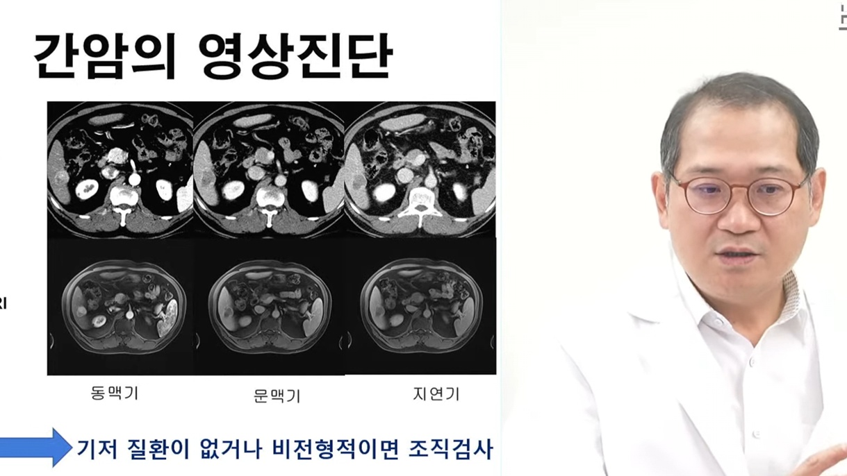 명의-지방간염-김지훈-