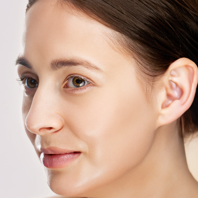 2. 모공 각화증의 증상