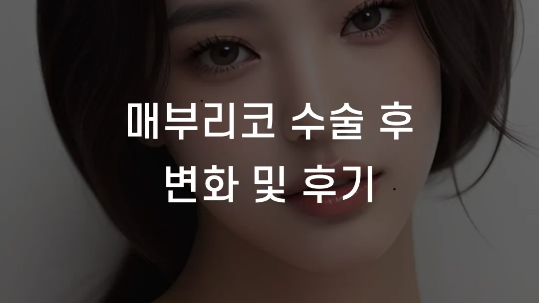 매부리코 수술 후 변화 및 후기