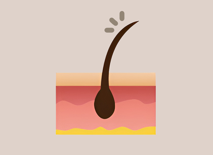 모발-및-손톱-강화