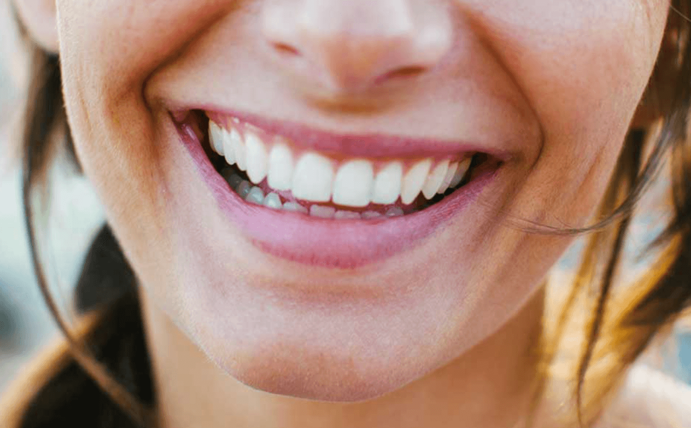 앞니 크라운 가격