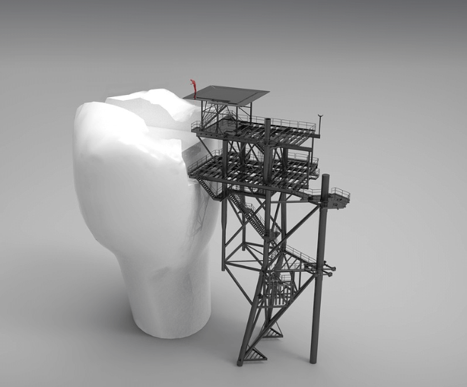 이빨 빠지는 순서