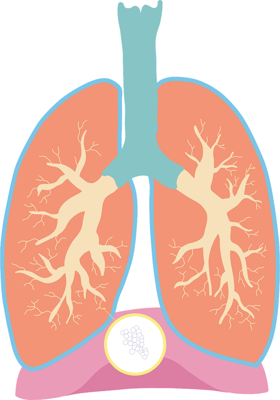 특발성 폐섬유증(IPF): 숨쉬는 것조차 힘겨운 병, 그 정체와 대처법