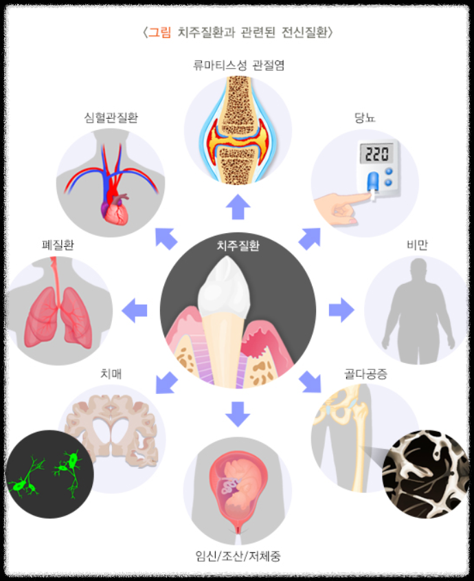 치주 질환과 관련된 전신 질환
