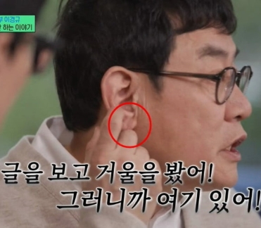 귓볼에 주름