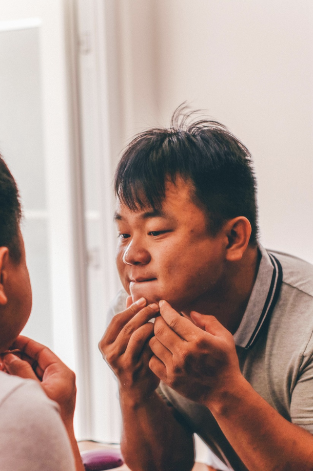 여드름 짜는 남자 사진