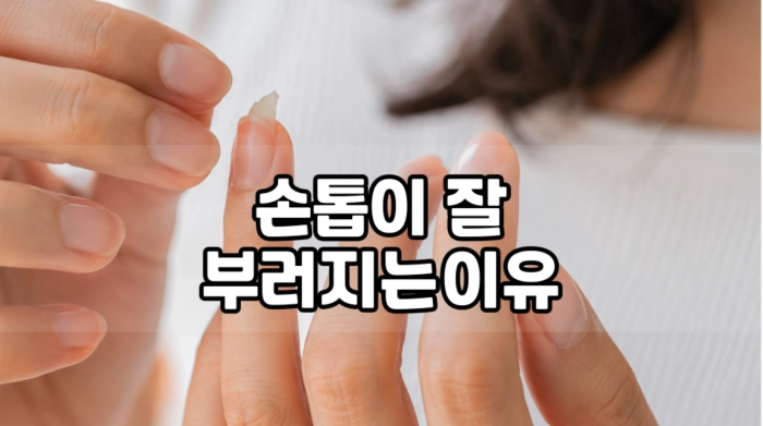 손톱이 잘 부러지는 이유