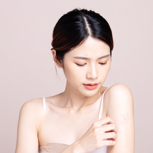 캐슈넛은 트리넛(tree nut) 계열로, 알레르기 유발 가능성이 높습니다