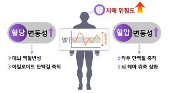 고혈압이 치매에 미치는 영향