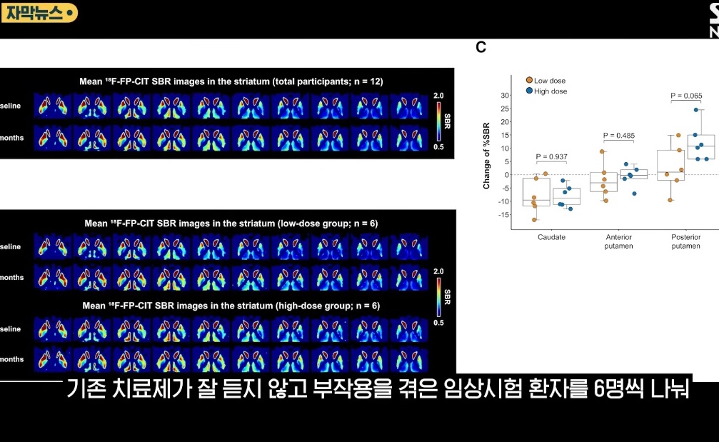명의-파킨슨-장진우-교수