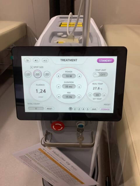 발톱 무좀 레이저 치료기