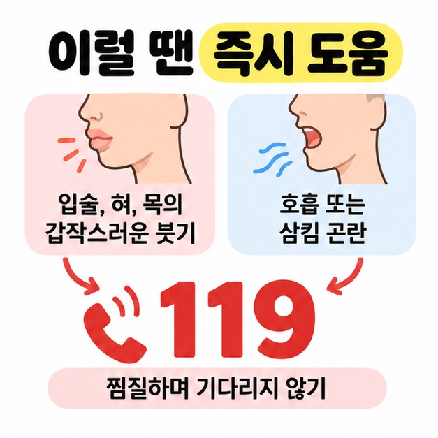 입술과 혀, 목의 갑작스러운 붓기 또는 호흡과 삼킴 곤란에서 각각 화살표가 큰 응급전화 번호로 이어지고 찜질하며 기다리지 않도록 안내한 도식