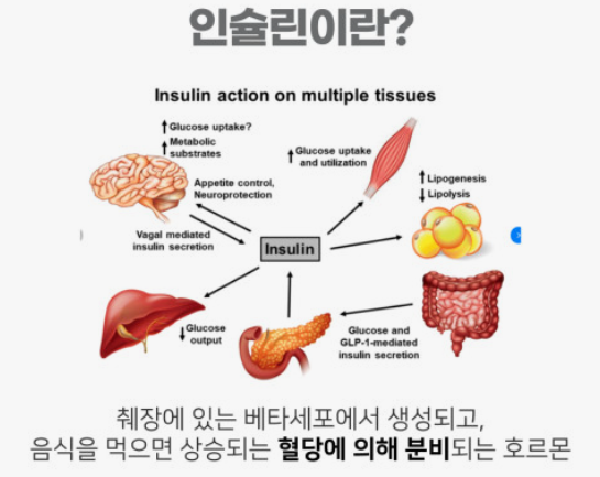 인슐린 설명