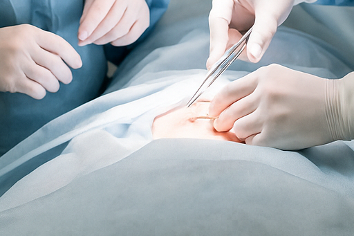 기흉 치료와 수술