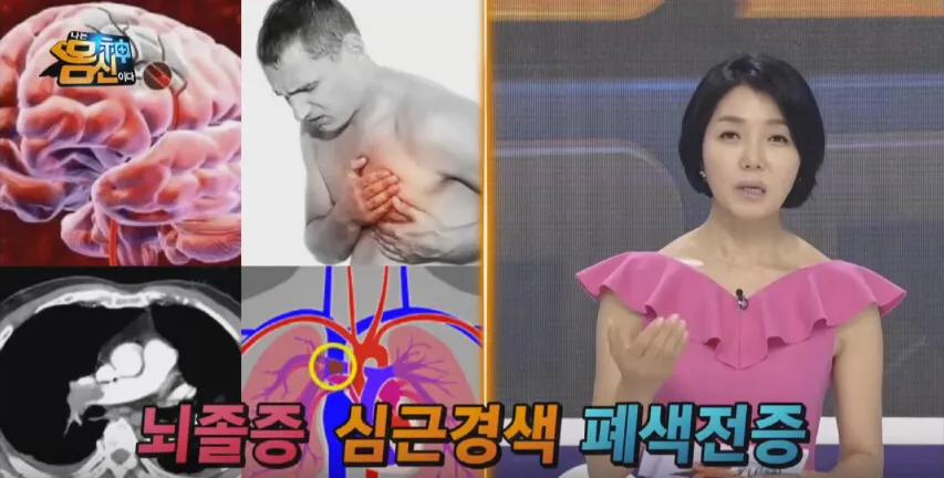 혈관 관리를 위한 방법