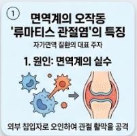 류마티스 관절염 초기증상
