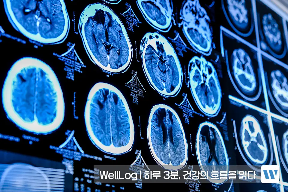 포스파티딜세린 효능 효과