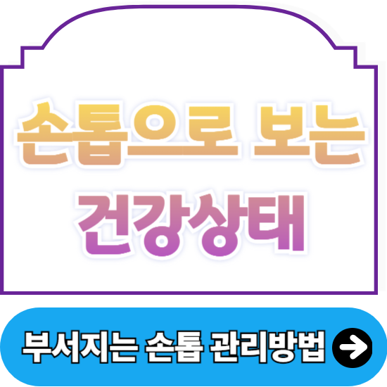 손톱으로 보는 건강상태 10가지