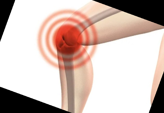 콘쥬란 주사 가격