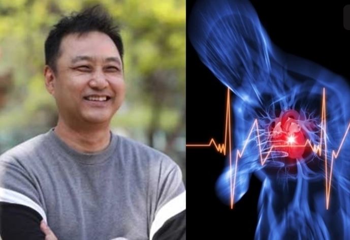 김수용, 급성 심근경색 발생 이유 초기 사망률 40% 극복 방법