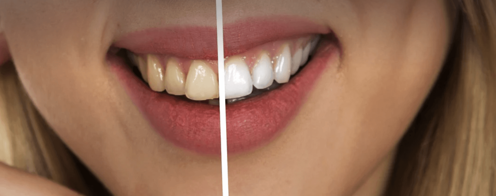 기능성 치약 가이드: 고체치약, 미백치약, 센서티브 치약 외.