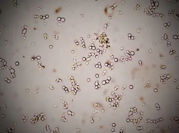 방광염 증상 및 치료법&amp;#44; 원인과 예방법