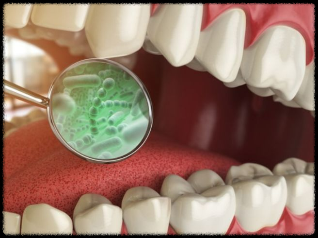 &amp;quot;덴티오클린&amp;quot; 구강 유산균 추천 이유는? 실제 복용자 후기 모음