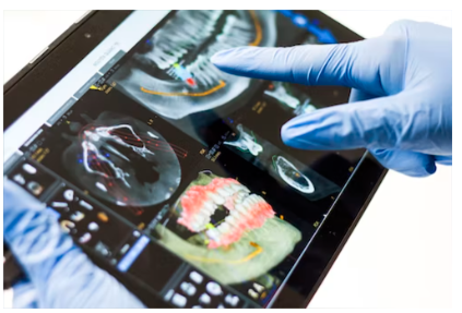 임플란트 장단점