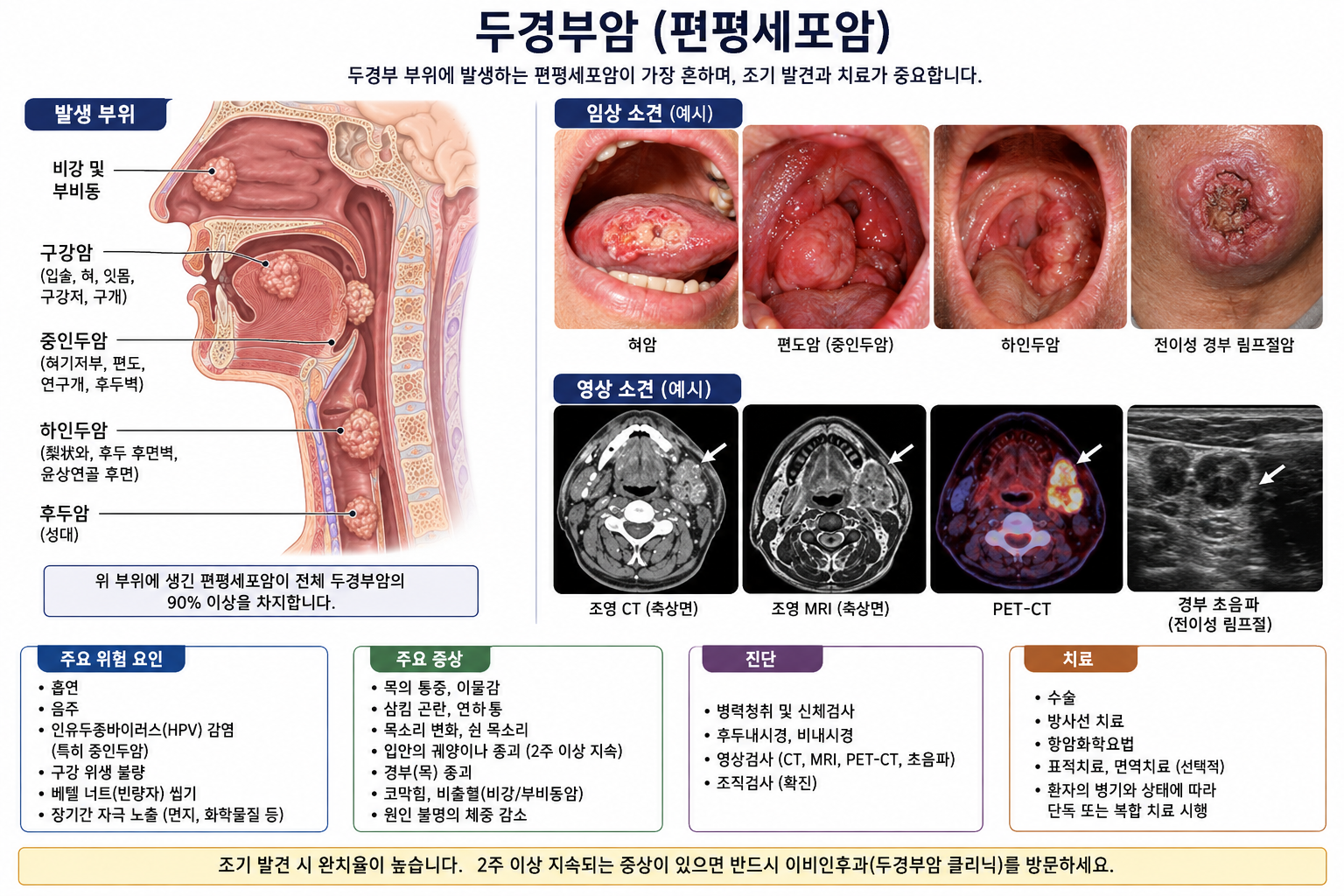 두경부암 이미지