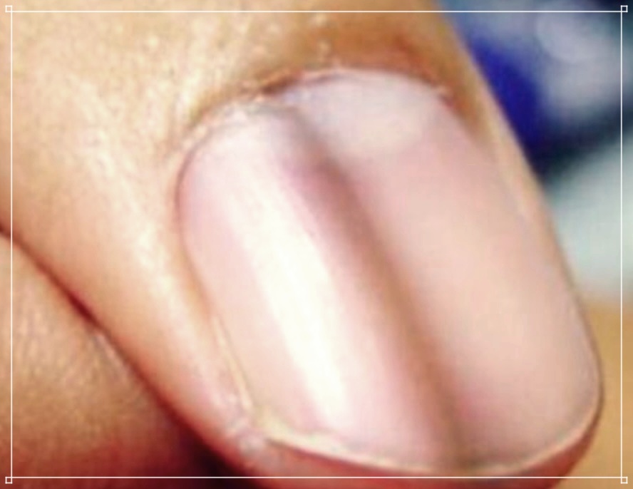 손톱 건강을 위한 일상 속 쉬운 손톱파임 예방법.