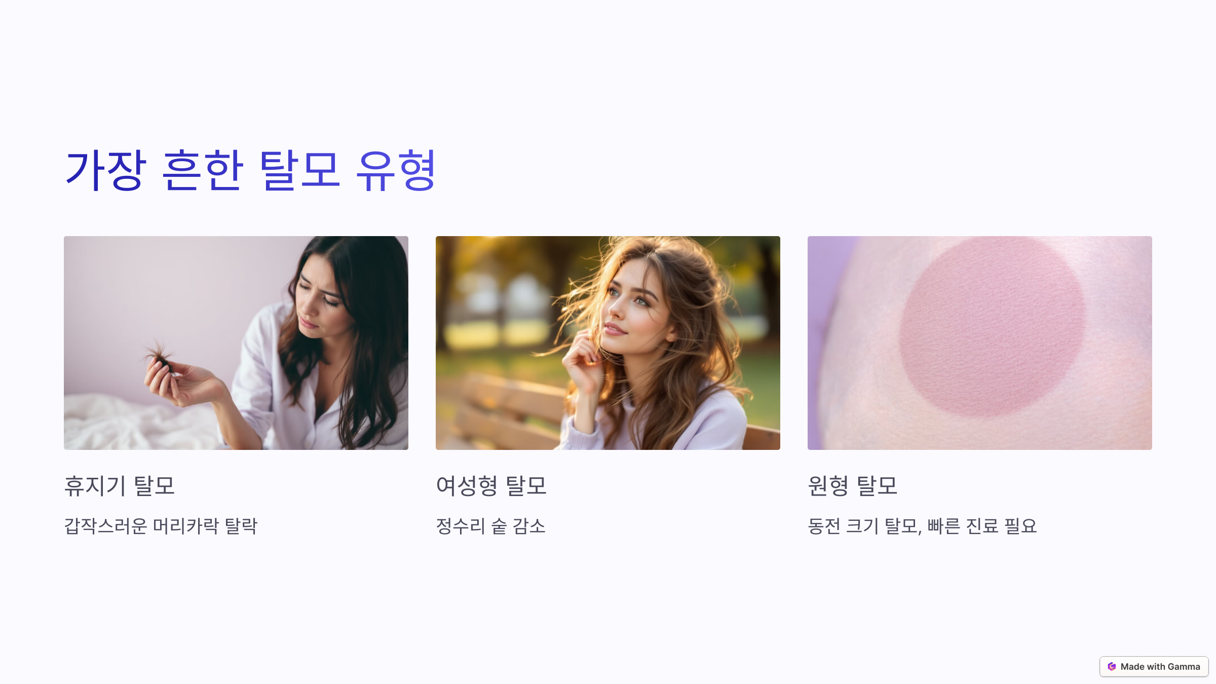 가장 흔한 탈모 유형