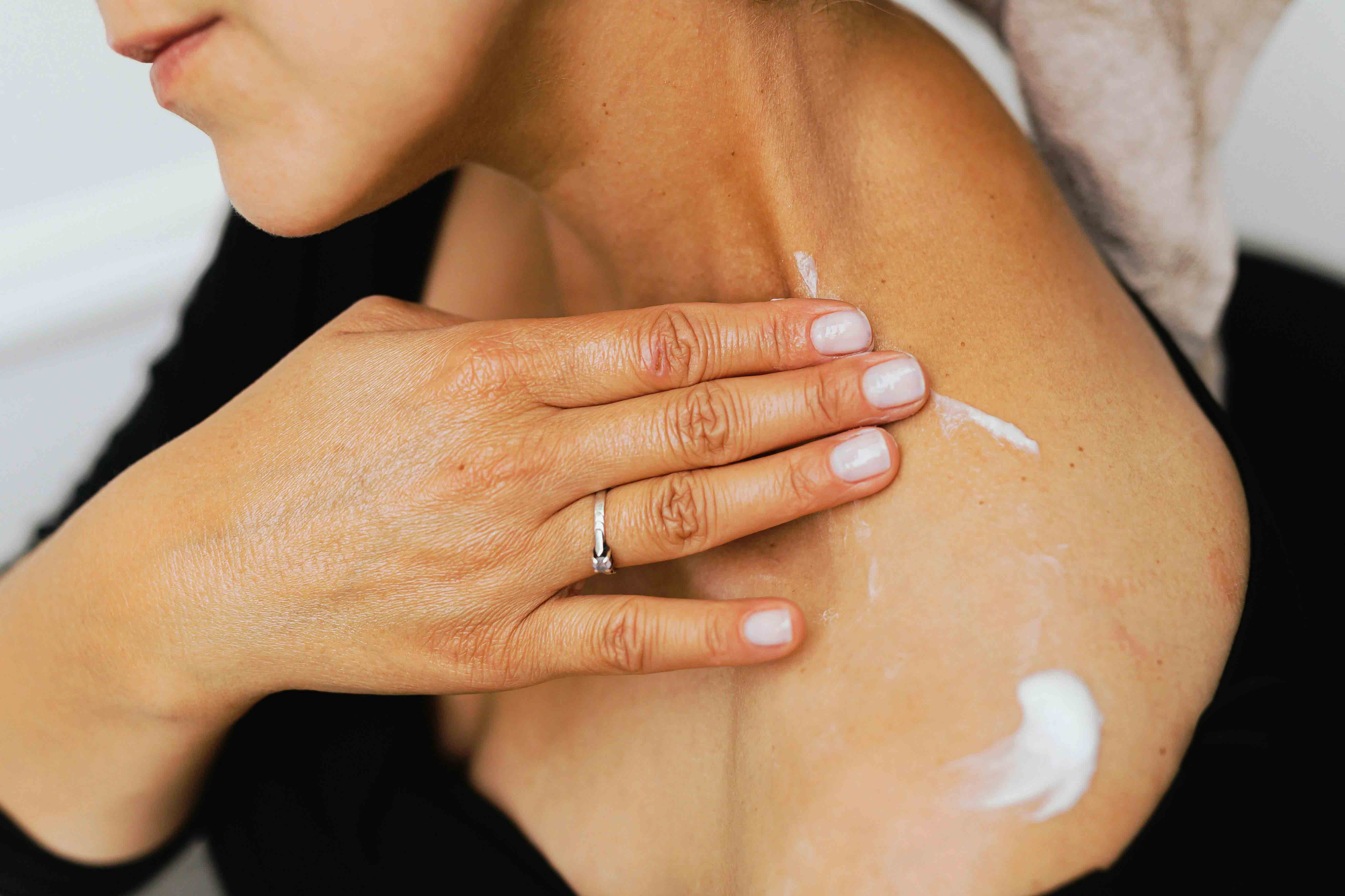 갑상선기능저하증 좋은음식 초기증상2