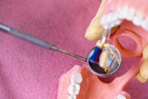 1차 수술 후 회복 기간