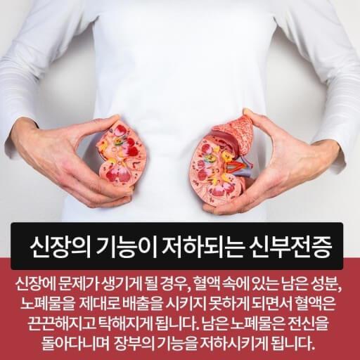 만성 신부전증