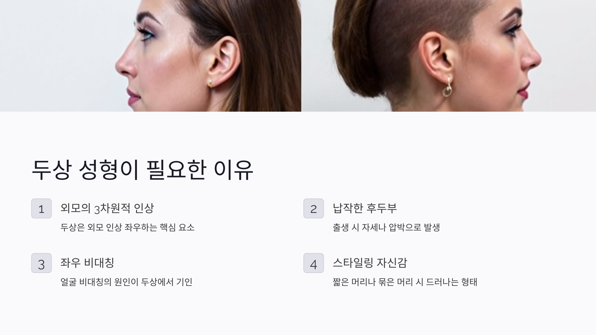 두상 성형이 필요한 이유부터 알아야 합니다