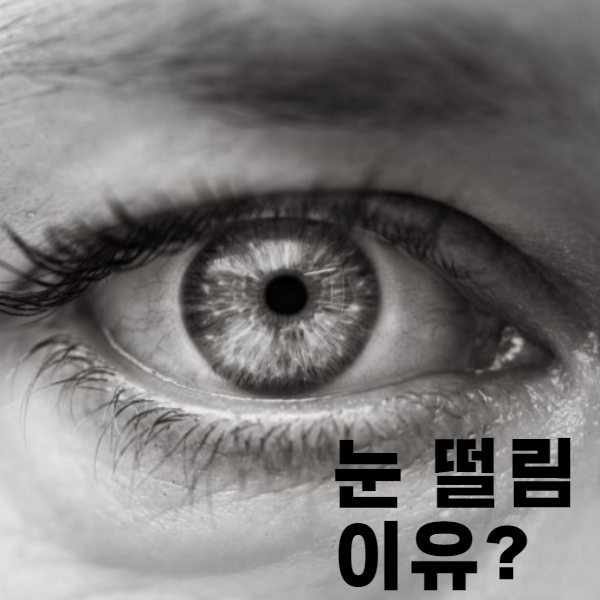 눈떨림 이유 : 눈 떨림현상