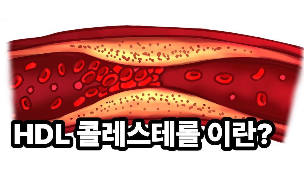 hdl 콜레스테롤 이란 사진 1