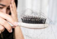 탈모-예방-방법