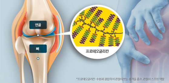 프로테오글리칸