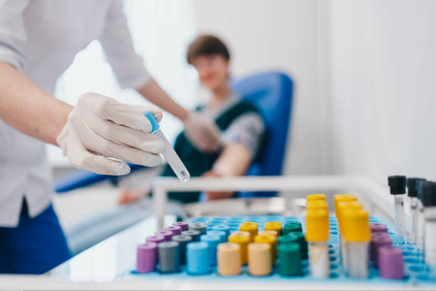 베체트병 치료 및 관리