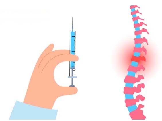 허리디스크 주사 관련 사진
