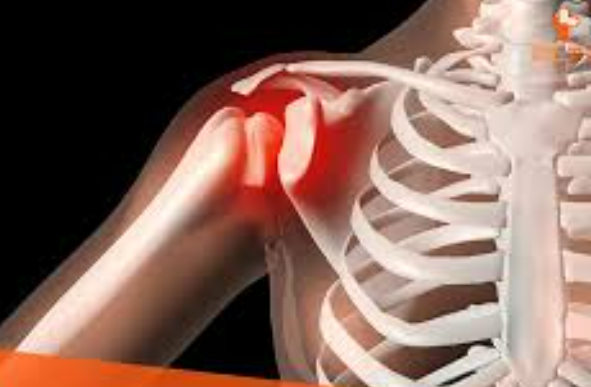 어깨 통증 원인