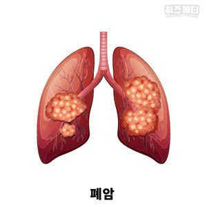 기침이 오래가는 이유