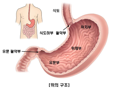 역류성 식도염 입냄새