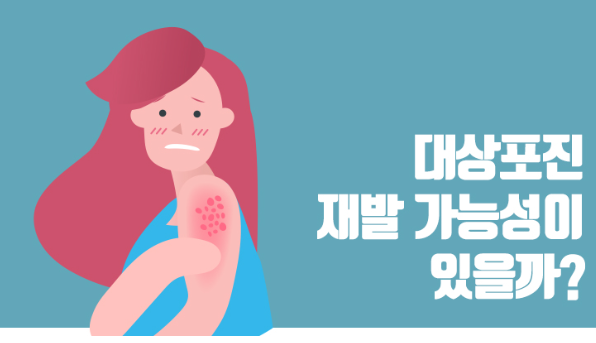 대상포진 재발