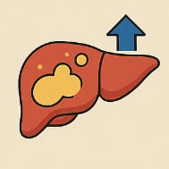 간수치가 올라가는 이유와 간수치 내리는 방법
