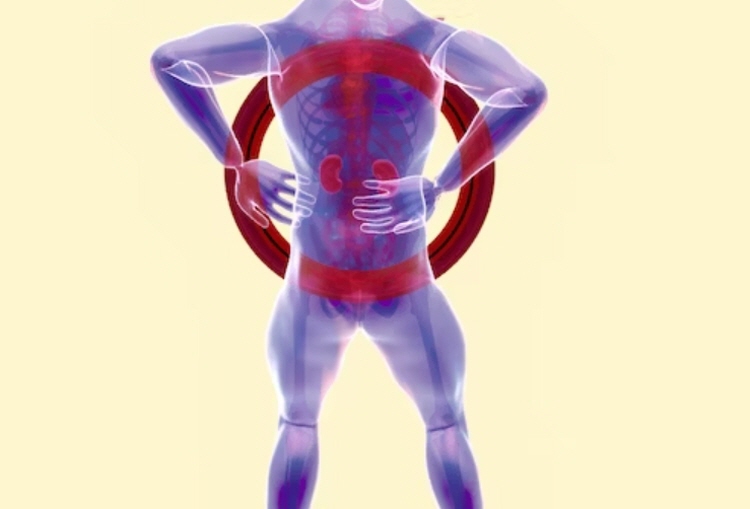 좌골신경통 증상